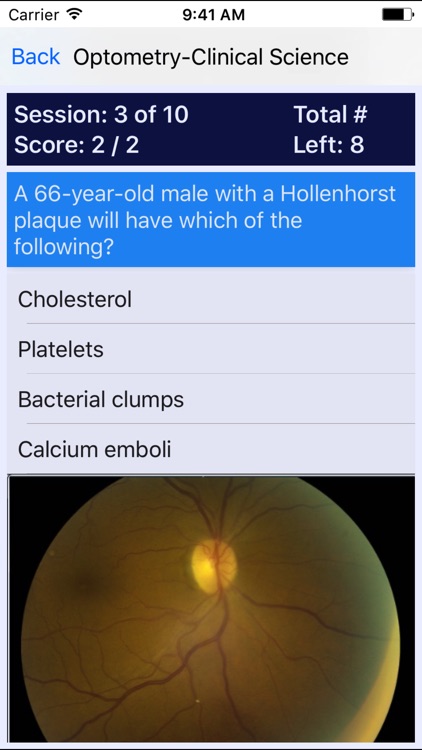 Optometry Board Reviews