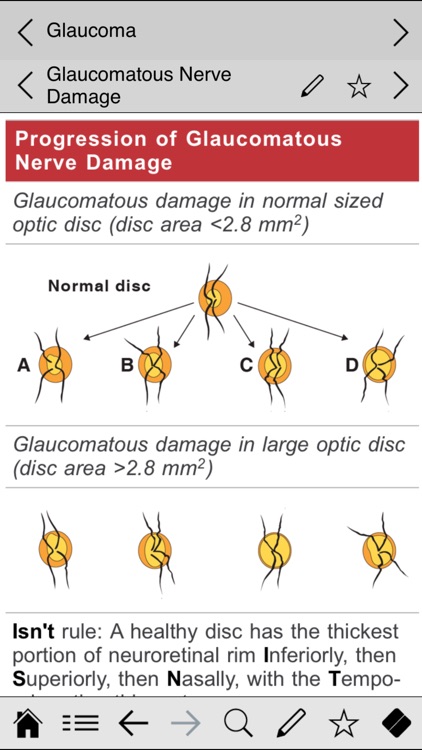 Ophthalmology pocket screenshot-4