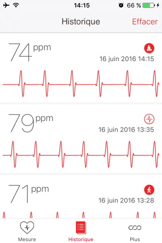 Cardiograph screenshot 3