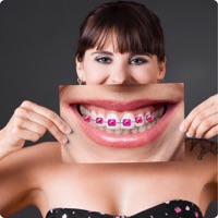 Braces App  PC 용