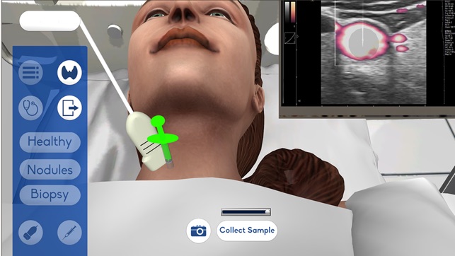 USCAP Thyroid Biopsy Sim