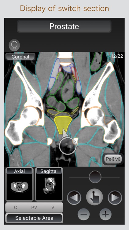 CT Passport Abdomen screenshot-3