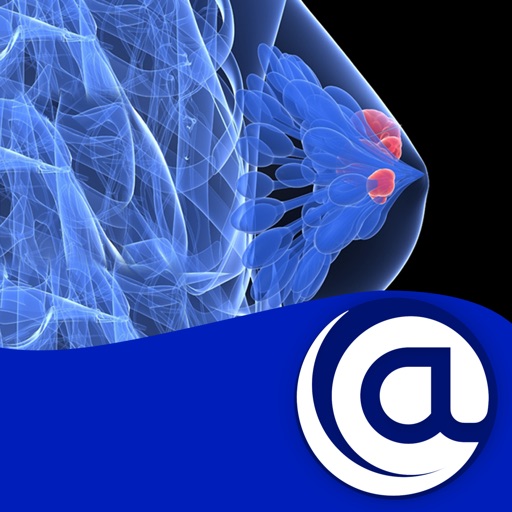 Breast Cancer @Point of Care™