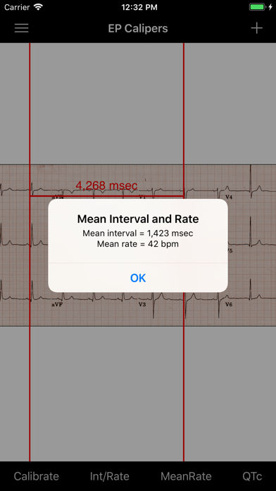 EP Calipers Screenshot 5