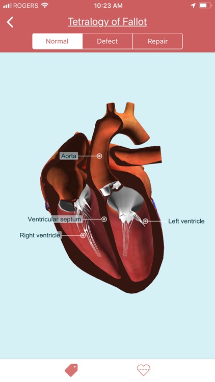 eMurmur Heartpedia screenshot-4