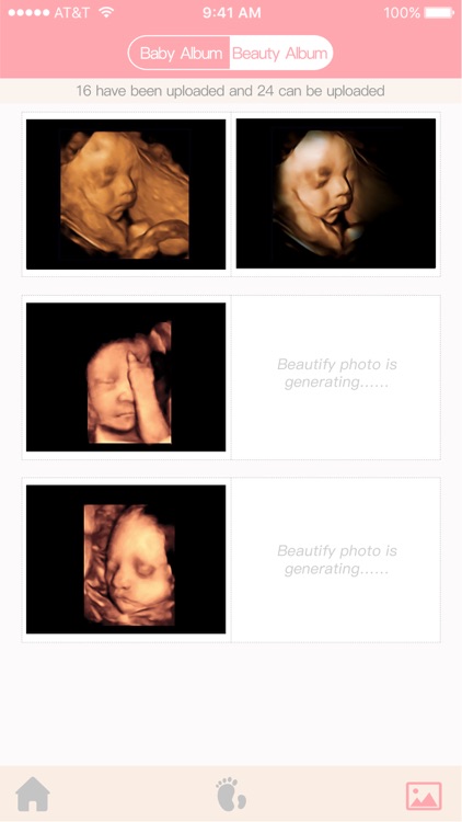 Fetus Camera screenshot-3