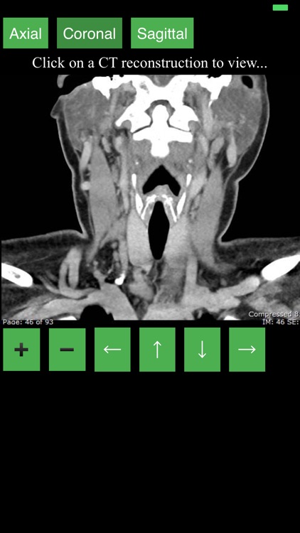 CT Neck