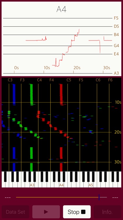 Vocalise Scope