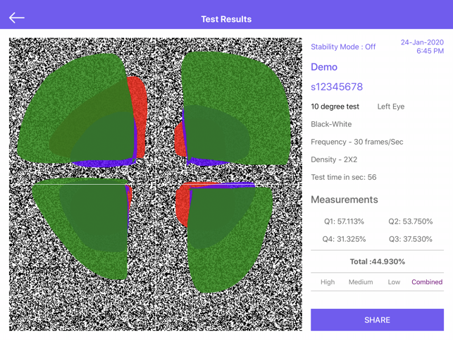 Visual Field Fast Pro(圖5)-速報App