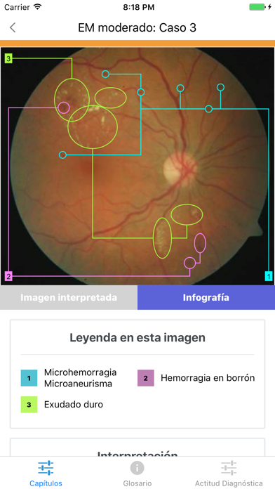 ATLAS Retinopatía Diabética screenshot 2