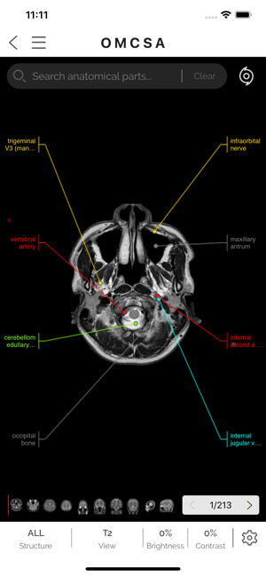 OMCSA k-anatomy(圖4)-速報App