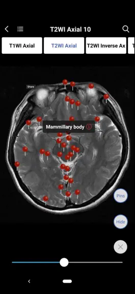 Game screenshot MedImaging-Radiology Made Easy hack