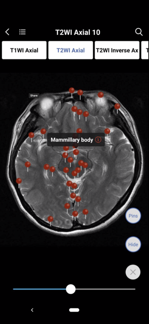 MedImaging-Radiology Made Easy(圖3)-速報App