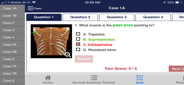 CTisus Chest Atlas 3D CRT(圖6)-速報App