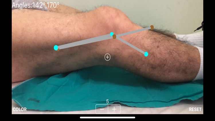 ARorthopaedicGoniometer screenshot-4