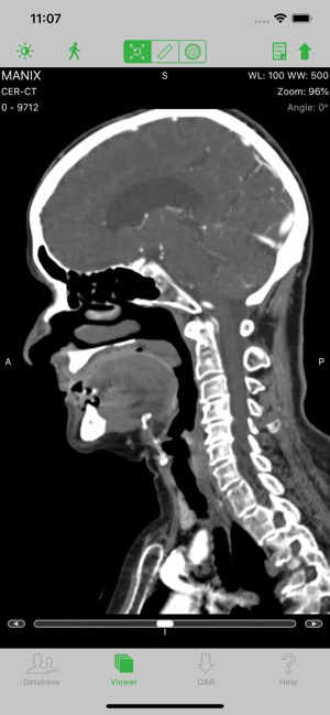 OsiriX HD