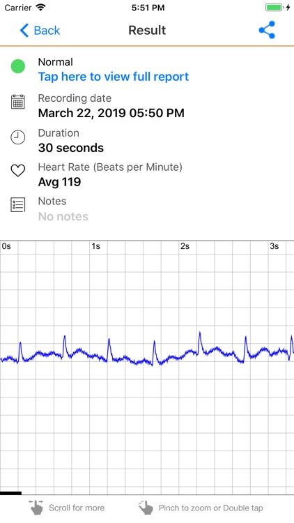 ECG Check