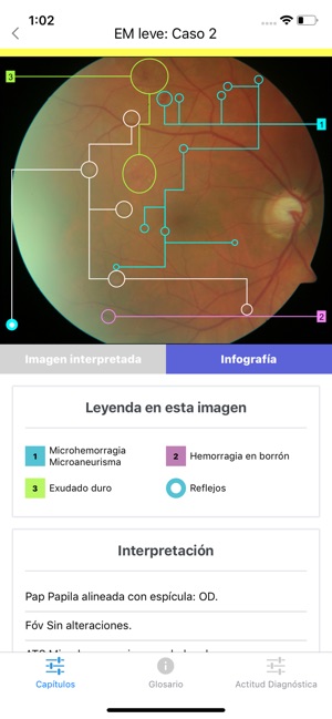 ATLAS Retinopatía Diabética(圖2)-速報App