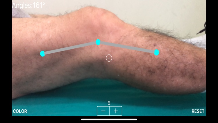 ARorthopaedicGoniometer screenshot-3