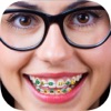 Icon Braces on Teeth – Stickers