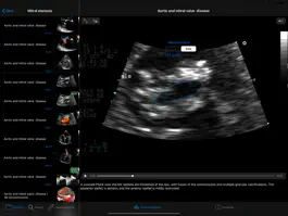 Game screenshot CARDIO3®Echocardiography HD apk