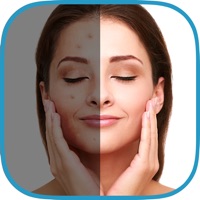 여드름 지우개 + PC 용