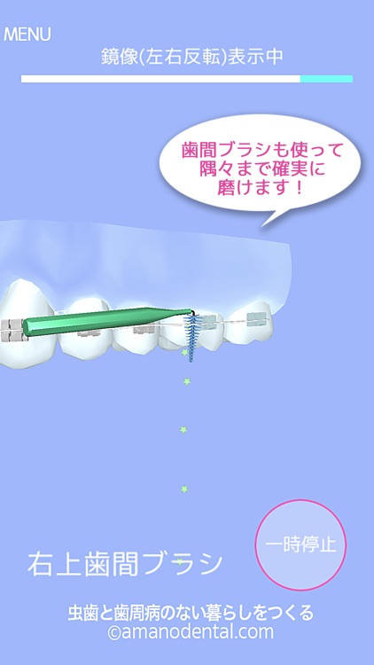 矯正歯磨き貯金 screenshot-4