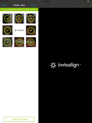 Invisalign Photo Uploader screenshot 4