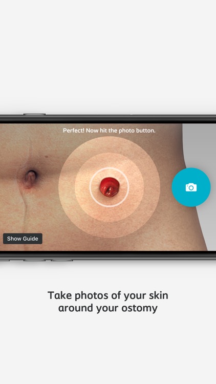 Ostomy Skin Care screenshot-3