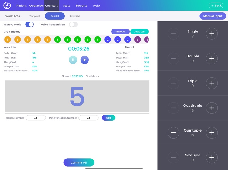 Graft Calculator