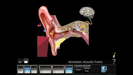 Game screenshot Ear Disorders: Outer Middle apk
