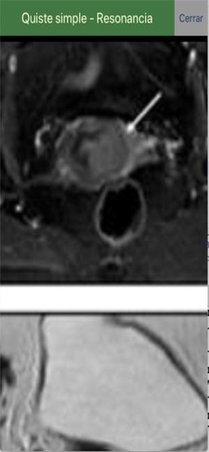 Telerradiología -Educativa(圖5)-速報App