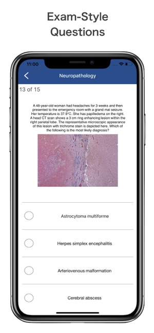 NEUROSURGERY Exam Prep 2020(圖6)-速報App