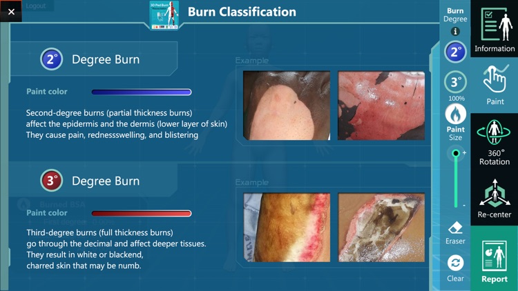 3D PED Burn Resuscitation screenshot-3