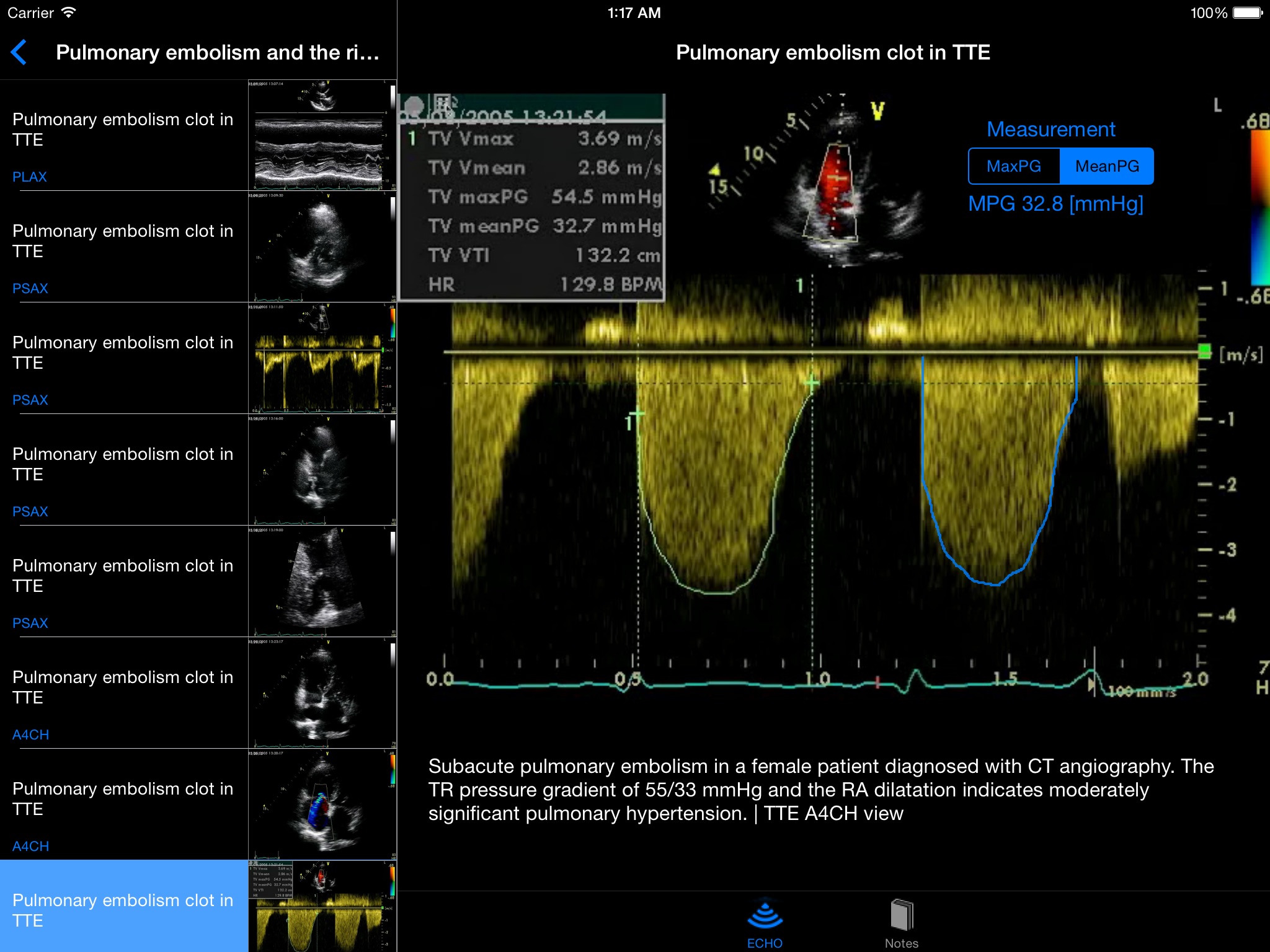 CARDIO3®Echocardiography HD screenshot 4