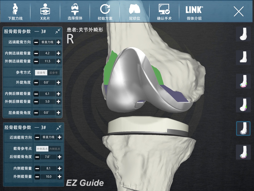 EZ Guide Knee screenshot 4