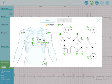 QT ECG screenshot 2