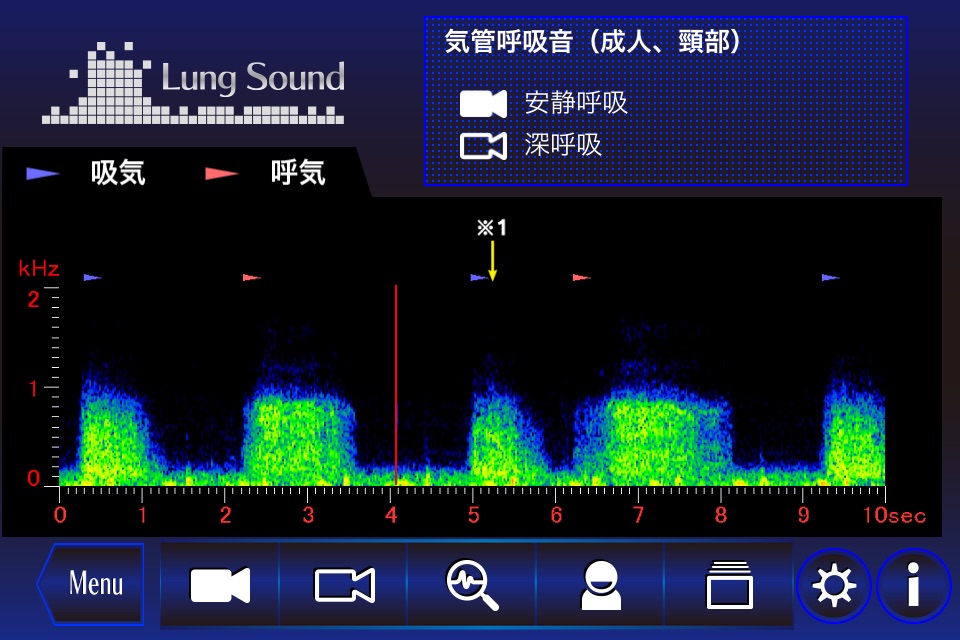 肺の聴診トレーニング - 見える肺音 screenshot 2