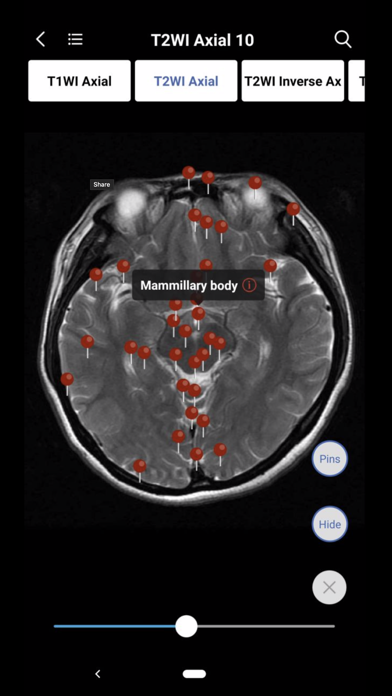 MedImaging-Radiology Made Easy screenshot 2
