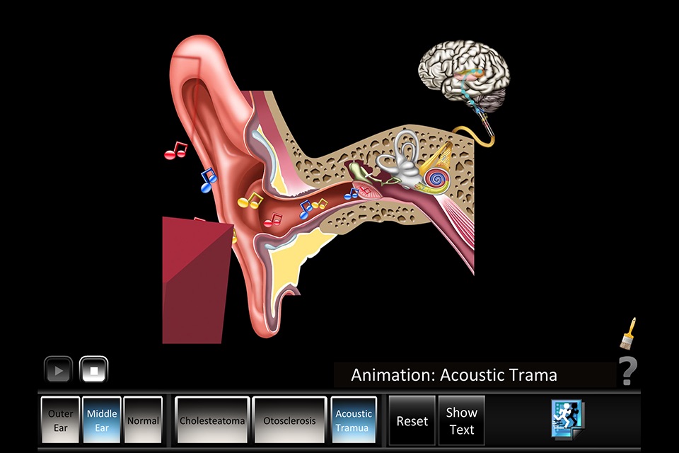 Ear Disorders: Outer Middle screenshot 2