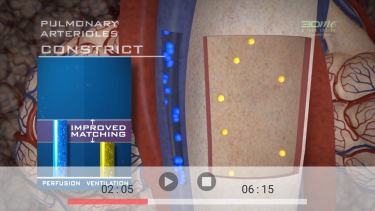 Ventilation Perfusion Matching