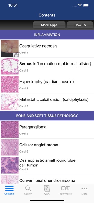 Anatomic Pathology Flashcards(圖2)-速報App