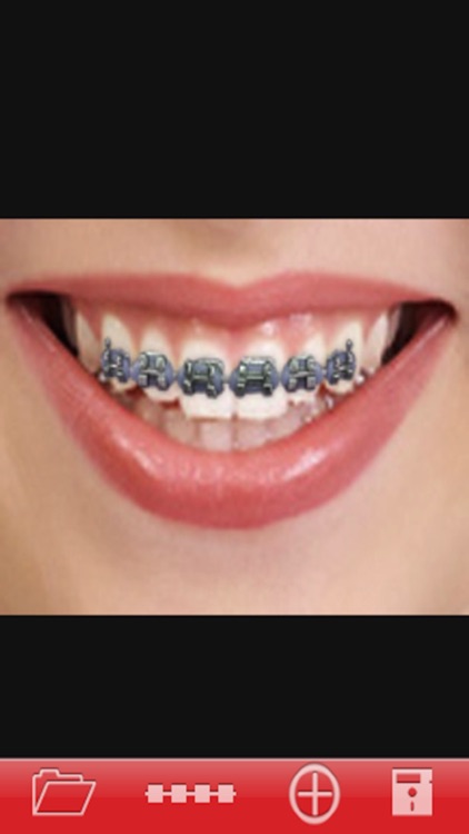 Orthodontic