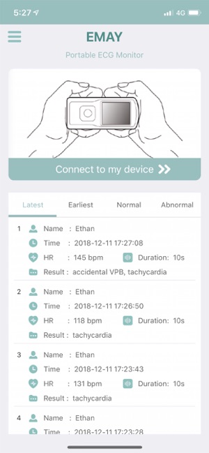 EMAY Portable ECG Monitor