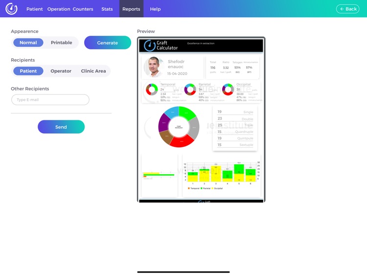 Graft Calculator screenshot-4