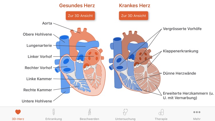 Herzstark in 3D CH