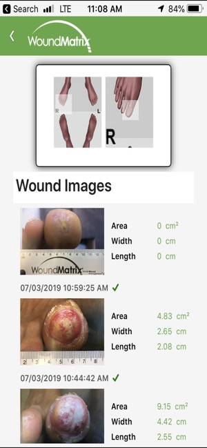 WoundMatrix Patient(圖2)-速報App