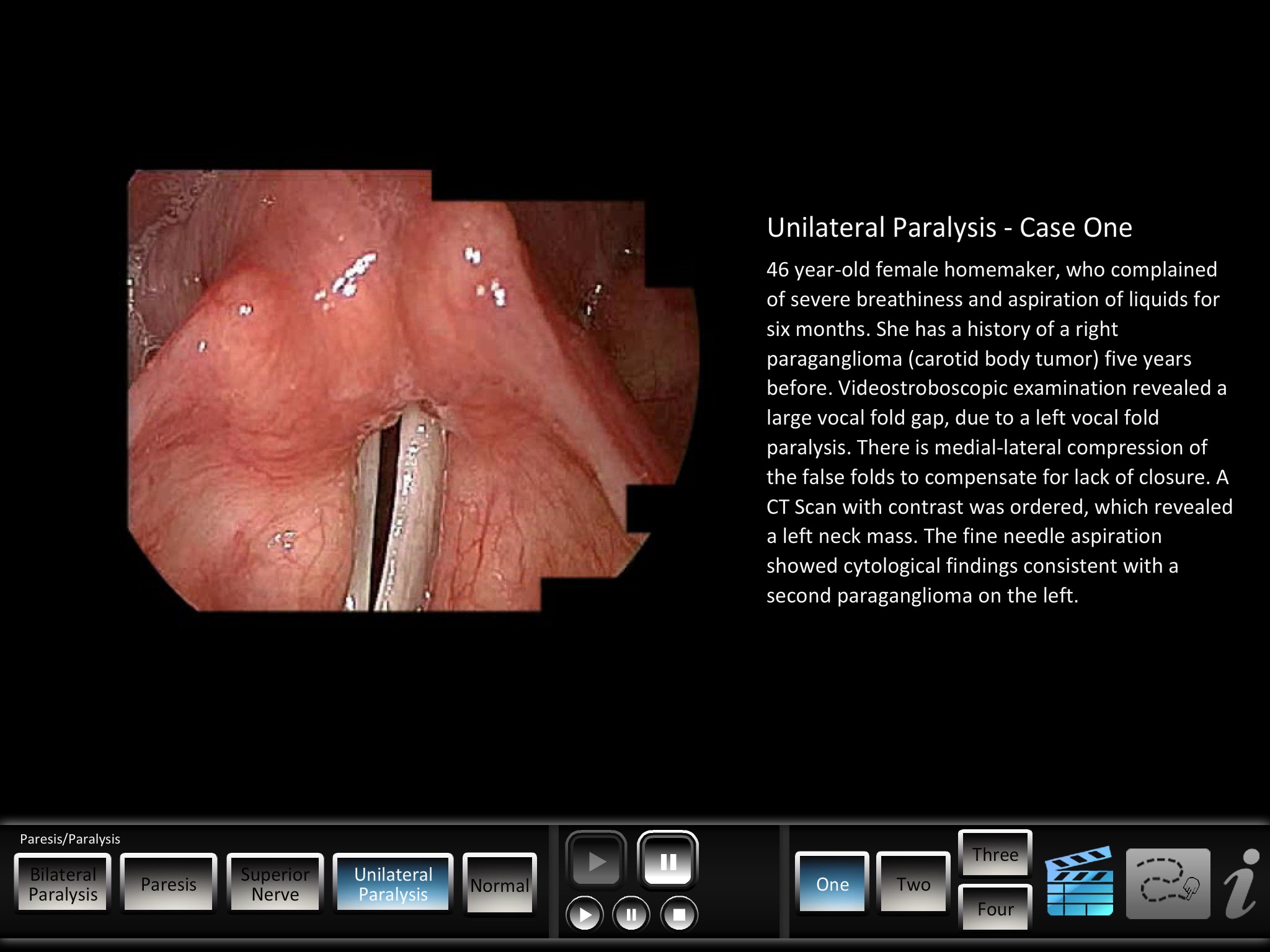 Paresis/Paralysis screenshot 3