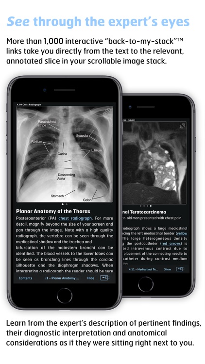 Radiology - Thoracic Imaging screenshot-3