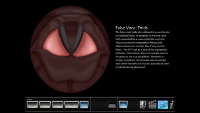 How to cancel & delete Vocal Pathology: Reflux from iphone & ipad 2